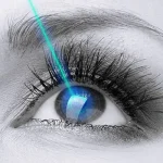 SMILE vs Contoura Vision: Which one should I go for?