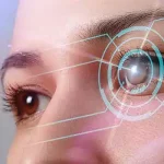 A comprehensive guide to SMILE Refractive Procedure