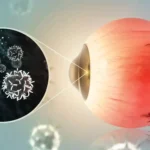 What are the first signs of eye cancer?