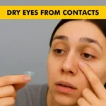 Dry Eyes from Contacts – Causes and Treatments