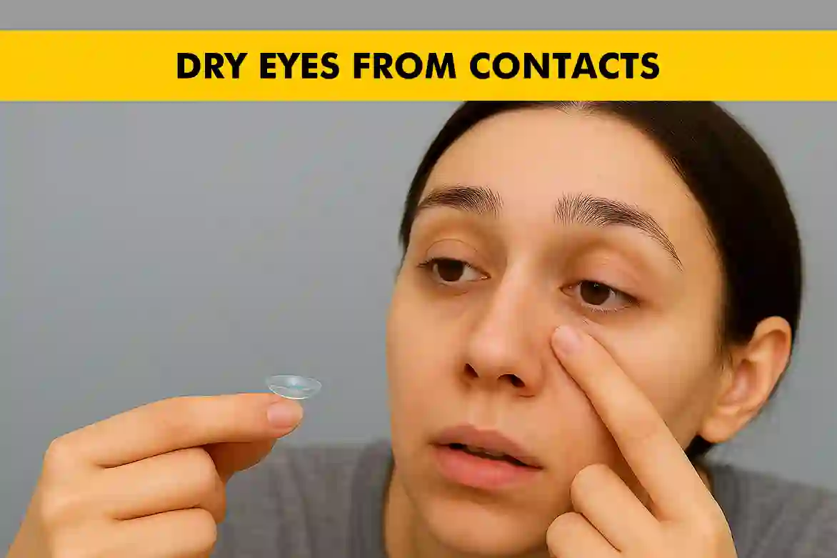 Dry Eyes from Contacts – Causes and Treatments