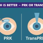 Which Is Better – PRK or TransPRK