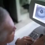 5 myths about cataract surgery