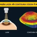 टोपोग्राफी-गाइडेड LASIK बनाम Contoura Vision