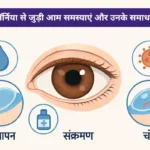 कॉर्निया की आम समस्याएं और उनके समाधान