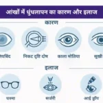 आंखों में धुंधलापन का कारण और इलाज