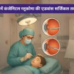 बच्चों में कंजेनिटल ग्लूकोमा की एडवांस सर्जिकल तकनीकें