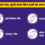 इंट्राओक्युलर लेंस (IOL)